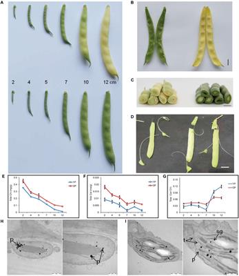 Enhanced Chlorophyll Degradation Triggers the Pod Degreening of “Golden Hook,” a Special Ecotype in Common Bean (Phaseolus vulgaris L.)